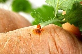 odstranjevanje papiloma s sokom zelišč iz celandina